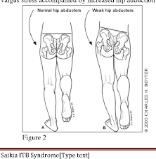 This causes inflammation and pain on the outside of the knee just above the joint. Etiology Treatment And Prevention Of Iliotibial Band Syndrome A Literature Review By Semantic Scholar