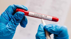 cdc says no to required covid testing