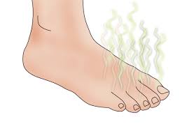 athlete s foot treatment symptoms