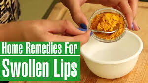 home remes to get rid of swollen lips