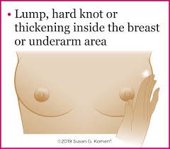 Possible symptoms of breast cancer to watch for include: Warning Signs Of Breast Cancer Do You Know What To Watch For