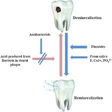 dental caries using nanomaterials