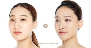South korea is the world leader in cosmetic surgeries. Here S Why 1 In 3 South Korean Women Say They Ve Had Plastic Surgery