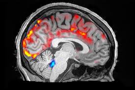 Cerebrospinal Fluid "Brain Washing" During Sleep | The Brink | Boston  University