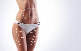 liposuction surgery in westchester new