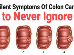 Presence of tumor results in narrowing of the colon, which in turn decreases the. 6 Silent Symptoms Of Colon Cancer To Never Ignore