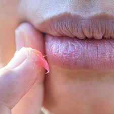 the best lip balm you should switch to