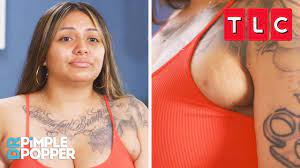 This Woman Has Two Extra Boobs!? | Dr. Pimple Popper | TLC - YouTube