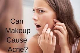 can makeup cause acne