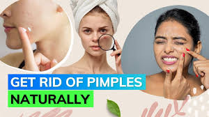 now get rid of pimples overnight with