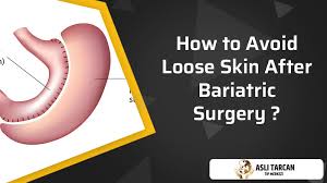 loose skin after bariatric surgery