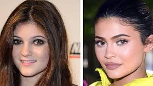 kylie jenner s shrinking lips