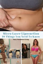 trisculpt micro laser liposuction 10