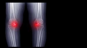 inner knee pain here are some of the