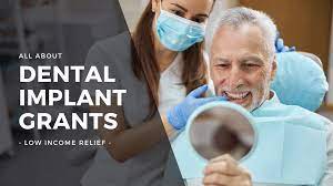 are dental implant grants real low