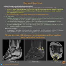 You are here:home / product pathology / haglund syndrome. Haglund Syndrome Msk Radiology Imaging Findings Grepmed