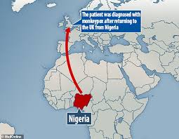 Monkeypox virus is an orthopoxvirus, a genus of the family poxviridae that contains other viral species that target mammals. Nhs Hospital Confirms Patient Has Monkeypox After Catching The Killer Virus While Visiting Nigeria Daily Mail Online