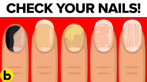 8 alarming things your nails is warning