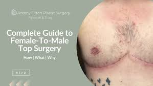 complete guide to ftm top surgery