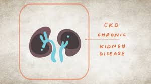 10 signs you may have kidney disease
