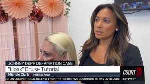 makeup artist gives hoax bruise