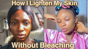 how i lighten my skin 2 shades lighter