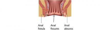 abscess symptoms causes