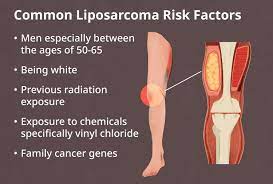 liposarcoma causes genetics radiation