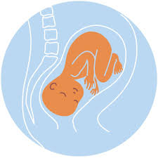 Baby OP position in womb