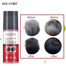 Grey or white hair is one the most embarrassing condition for people especially women, if premature graying will occur at teenage or small age then this will be a worse condition here, we are discussing some of home remedies, caring tips and white hair treatments to have black, long and shiny hair. One Period Of Treatment 3 Bottle Cure Grey Hair Treatment Spray From Root No Side Effect Hair Scalp Halal Marketplace