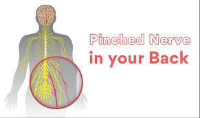 a pinched nerve may be causing your