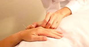 Eastern Acupuncture and Wellness gambar png
