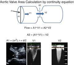 Valvular Quantification Thoracic Key