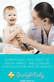 Unlike varicella (chickenpox) virus, which never really goes away and can cause herpes zoster (shingles) years later, molluscum contagiosum virus doesn't stick around after you heal. Everything You Need To Know About Molluscum Contagiosum Water Warts Kinacle