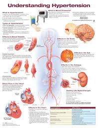 Understanding Hypertension Laminated Anatomical Chart 2nd Edition