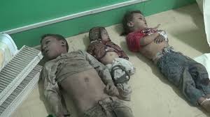 Image result for ‫جرائم العدوان على اليمن‬‎