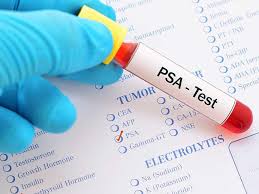 prostate specific antigen psa test nci