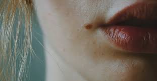 lip reduction surgical procedure side