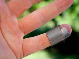 duct tape for warts how and why it works