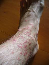 chiggers the myths and the facts