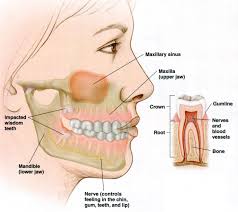 wisdom teeth kids dental in plano and