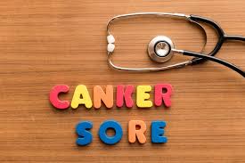 7 home remes for canker sores