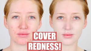 how to cover redness pigmentation on