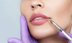 kiss your other lip fillers goodbye