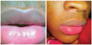 nigerian women find pink lips
