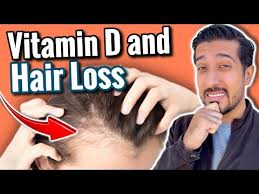 vitamin d deficiency hair loss is