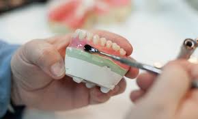 best denture making materials