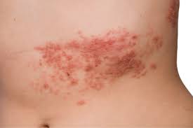 skin rashes conditions types when