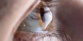 Myopia Control Lenses