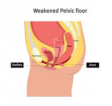 muscle weakness in pelvic floor or core